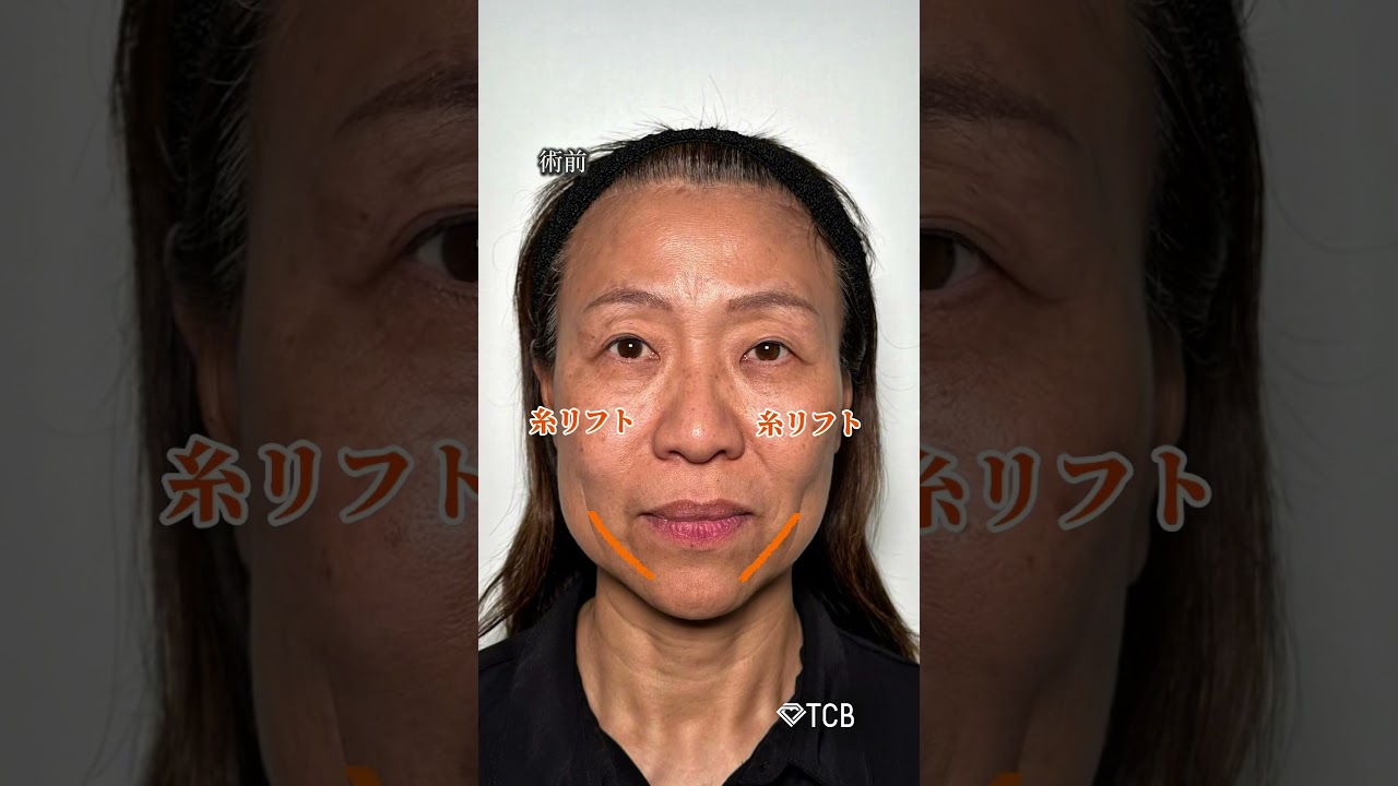 Youtubeのサムネイル