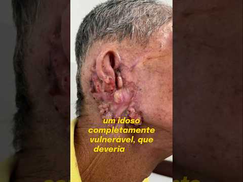 PROTOCOLO 202554100767:  A HISTÓRIA POR TRÁS DE UM PEDIDO SEM RESPOSTA #lagartose #vergonha #saúde