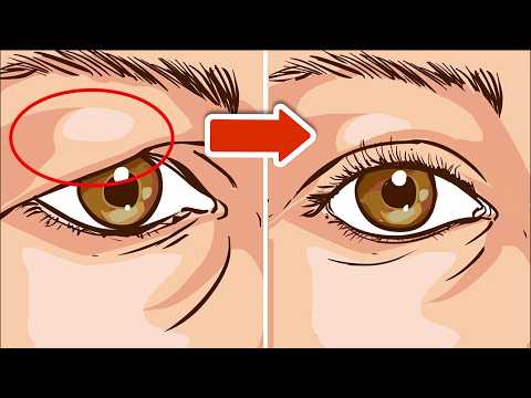 Drooping eyelids disappear INSTANTLY with these 5 tricks💥 (Super easy)🤯