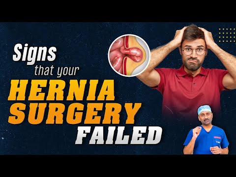 Failed Hernia Surgery Symptoms | Signs That Your Hernia Repair Failed - Dr. Parthasarathy