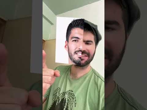 HOSPITAL DE FILTROS DEL MUNDIAL - #shorts