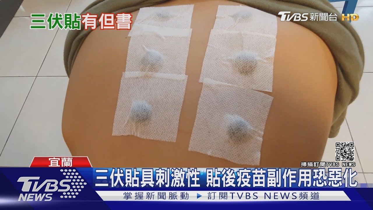 貼「三伏貼」 中醫:打疫苗三天內不適合