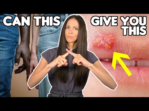 Can You Get Genital Herpes From Cold Sores?