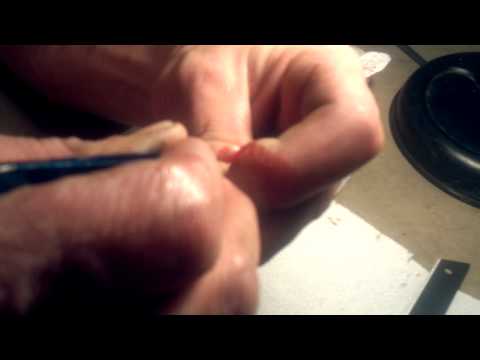 comment soigner furoncle doigt