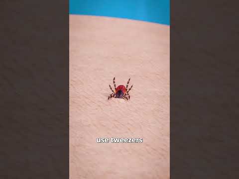How To Remove A Tick 🤢