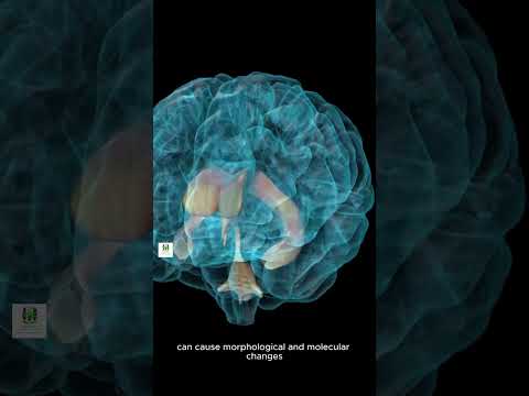 Cracking Joints and Neurological Health: Unveiling the Hidden Connections