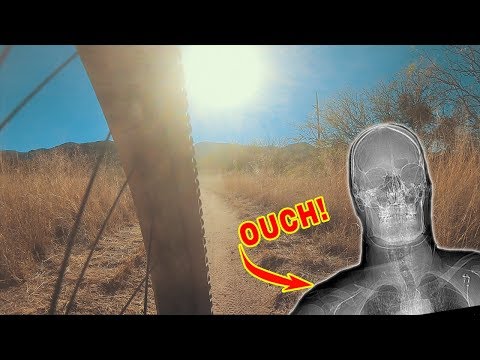 MY WORST MTB CRASH SO FAR | Family MTB | Episode 7