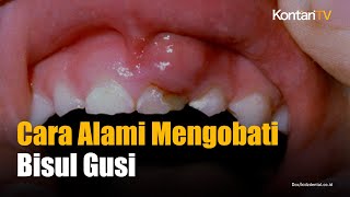 Download lagu 3 Cara Alami yang Efektif Mengobati Bisul Gusi | KONTAN News mp3
