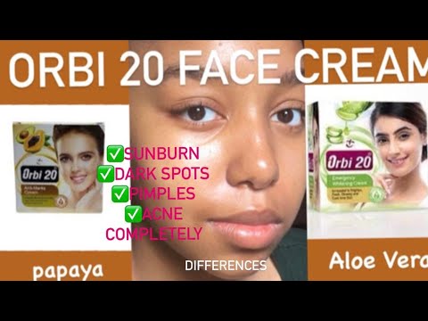 ORBI 20 FACE CREAM/DIFFRENCES ALOE VERA & PAPAYA. HOW EFFECTIVE IT IS? #facecream #darkspots #acne