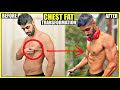 CHEST FAT TRANSFORMATION | My Before & After