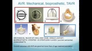 Prof David Celermajer: Follow up after aortic & aortic valve surgery