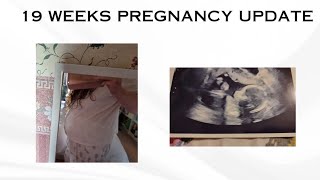 19 WEEKS PREGNANCY UPDATE/ANATOMY SCAN/SYMPTOMS/LOW DOSE ASPIRIN