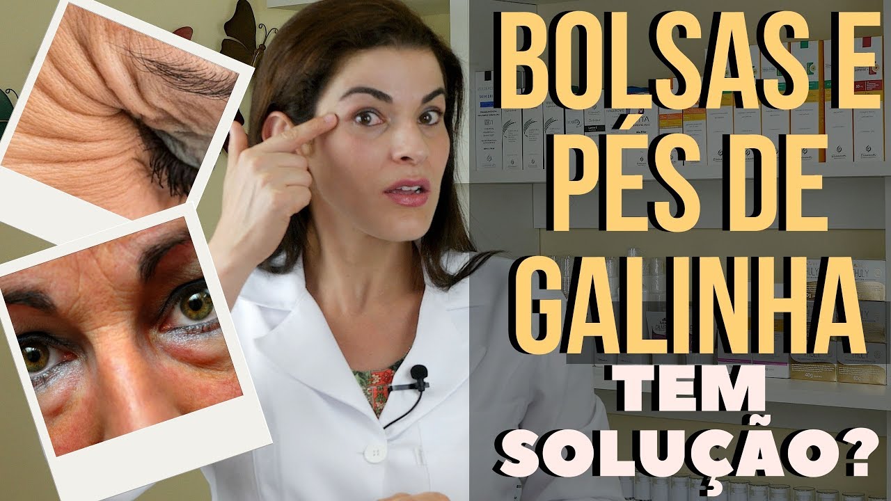 EYE BAGS AND CROW'S FEET - IS THERE A SOLUTION?- Is there a solution?