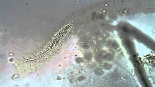 <em>Stichotricha</em> in mucilaginous lorica