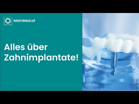 Zahnimplantate heute: Vorteile, Behandlungsdauer und Risiken im Überblick