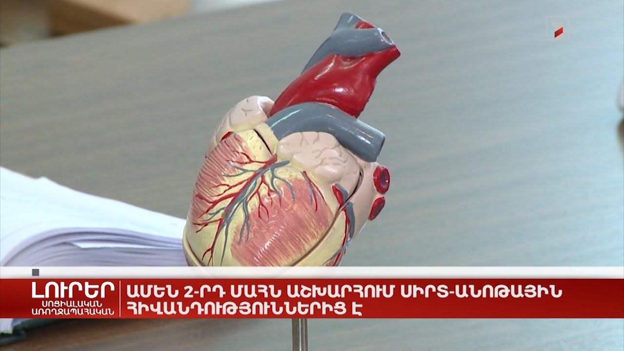 Ամեն 2-րդ մահն աշխարհում սիրտ-անոթային հիվանդություններից է