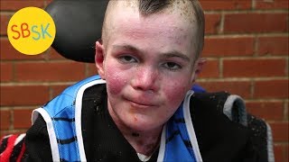 Marky&#39;s Mission (Helping His Mom Accept His Short Life Expectancy)