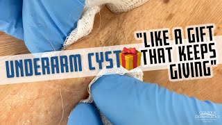 This Underarm Cyst is Like A Gift That Keeps Giving