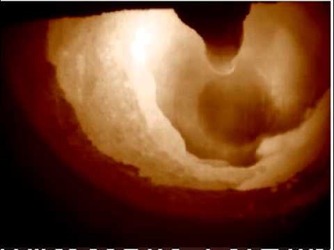 Preview for Zinc recovery