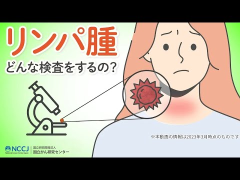 リンパ節腫脹について詳しく解説