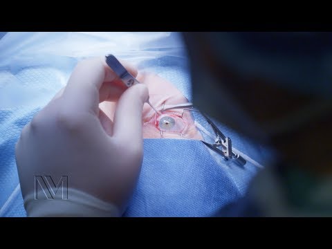 Inside the OR: Ocular Surgery