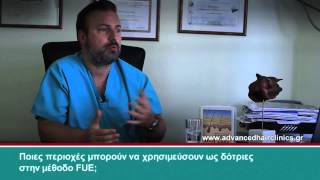 Ανώδυνη Μεταμόσχευση Μαλλιών Advanced FUE (Μέρος 2ο) - Δρ. Αναστάσιος Βεκρής