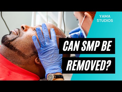 Can Scalp Micropigmentation Be Removed? A Hawaii SMP Practitioner Explains