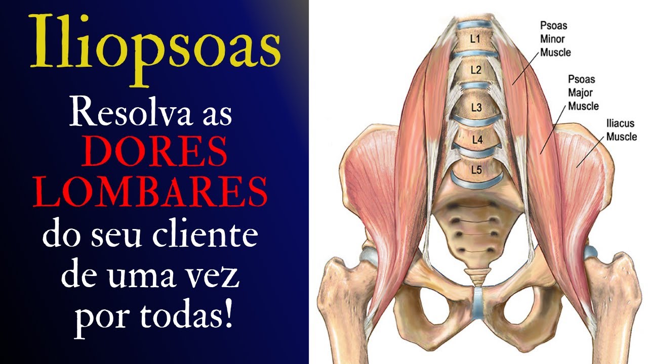 COMO ELIMINAR AS DORES LOMBARES! (Soltura do iliopsoas) - Davi Stemler