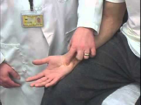 Ulnar Compression Test