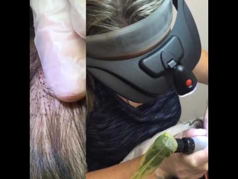 Best Scalp Micropigmention Training by SMC - The Leaders in the SMP Industry