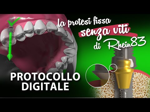 EASY FIX digital protocol