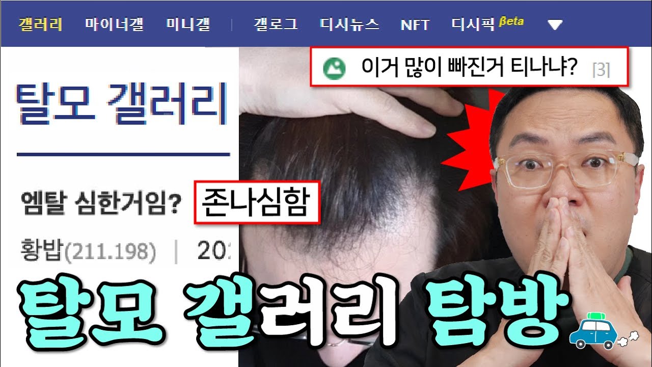 탈모 갤러리 리뷰<br />
(탈모 상담해 드립..