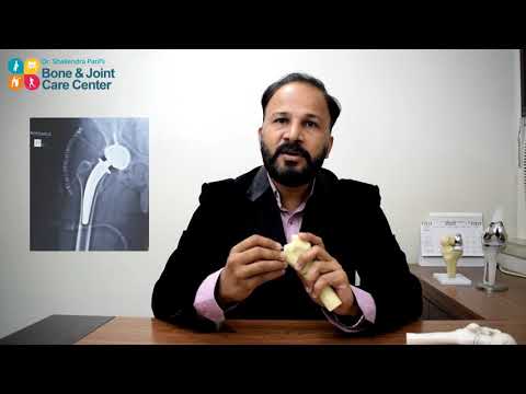Explaining What Is Anatomical Hip Replacement Surgery in Navi Mumbai?