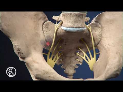 Easing SI Joint Dysfunction Pain with the "Catamaran" Tenon Medical - 4K Animation