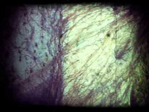 La Cueva del Ermitaño - Código 21