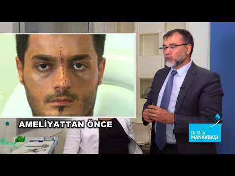 Op. Dr. İlker Manavbaşı - Estetik Mucizesi