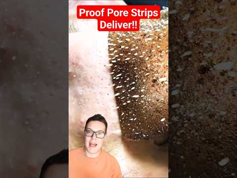PROOF PORE STRIPS WORK - Phenomenal Pore Strip Removal #shorts