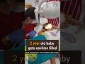2 Year Old Baby Gets Teeth Cavities Filled No Pain No Tears Dr Srishti Bhatia Baby Smile
