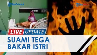 Cekcok Masalah Uang, Pria di Musi Rawas Tega Bakar Istrinya Hidup-hidup, Korban Terluka Parah