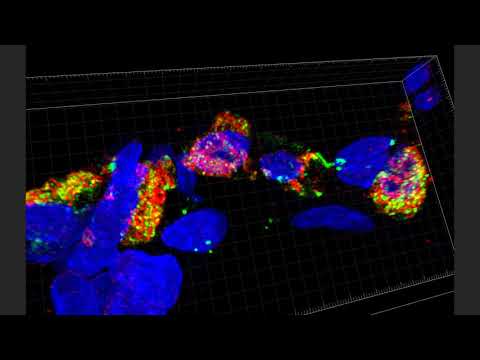 4 Month-Old Human Lung D075 4 Month-Old Human Lung D075