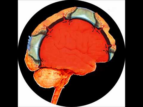 REEDITED 2016 [Deviant Orbit 01] Cyclic Backwash - Cortex Subduction