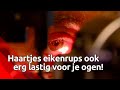 Meer oogklachten door de eikenprocessierups, maar 'er is geen enkele reden voor paniek'