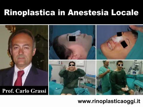 Fare una radiografia dellarticolazione dellanca Trattamento di un nervo schiacciato indietro