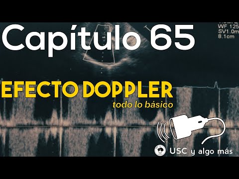 Capítulo 65: Efecto Doppler