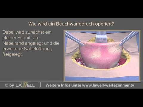 Die wirksamsten Medikamente für Rückenschmerzen Bücher über Massage Osteochondrose