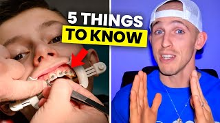 Watch THIS before taking your Child to an Orthodontist…| Orthodontist Explains