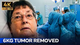 They Told Her 3 Months to Live: The Miracle 6kg Tumor Surgery | Hospital 4K