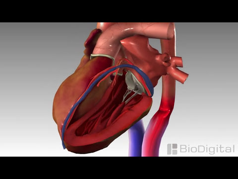 3D Medical Animation - Congestive Heart Failure