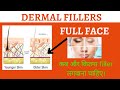 what are dermal fillers and their various uses. कब और कितना filler लगवाना चाहिए