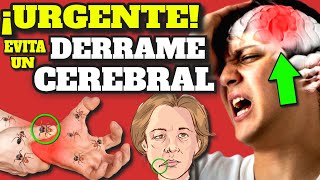 ¡PELIGRO! SÍNTOMAS de ALARMA de DERRAME CEREBRAL| ACV TRATAMIENTO y COMO EVITAR